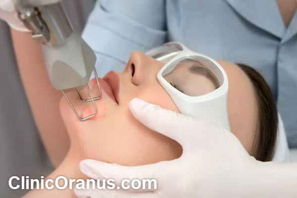 بررسی کاربردهای لیزر CO2 فرکشنال | کلینیک اورانوس