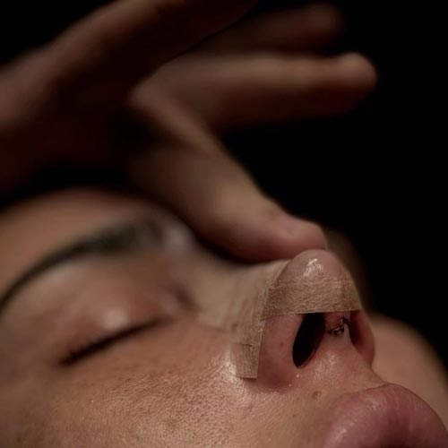 نتیجه جراحی بینی نیمه فانتزی