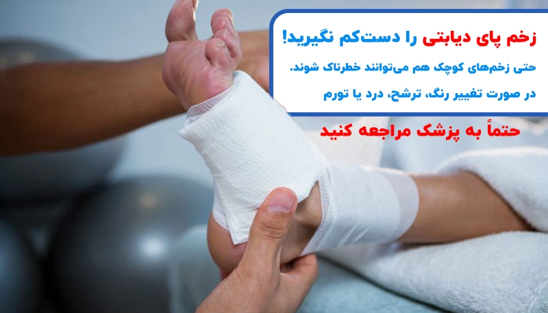 اهمیت پیشگیری در زخم پای دیابتی