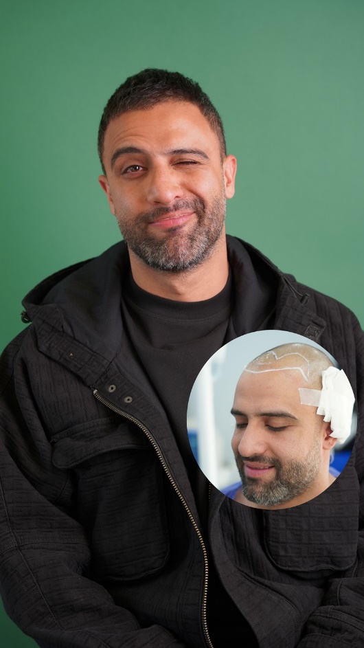 mpC3A2fYYShiR0DuLeiMzKYlhgPhL0Fuz6OWwvSV