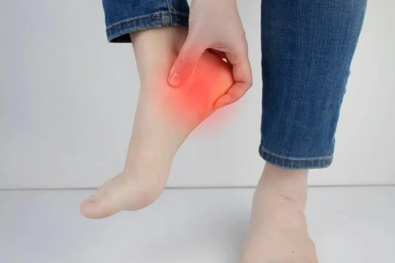 عوامل مؤثر بر بروز خار پاشنه؛ چرا این عارضه ایجاد میشود؟