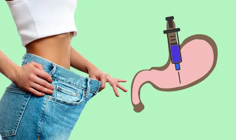 بوتاکس معده