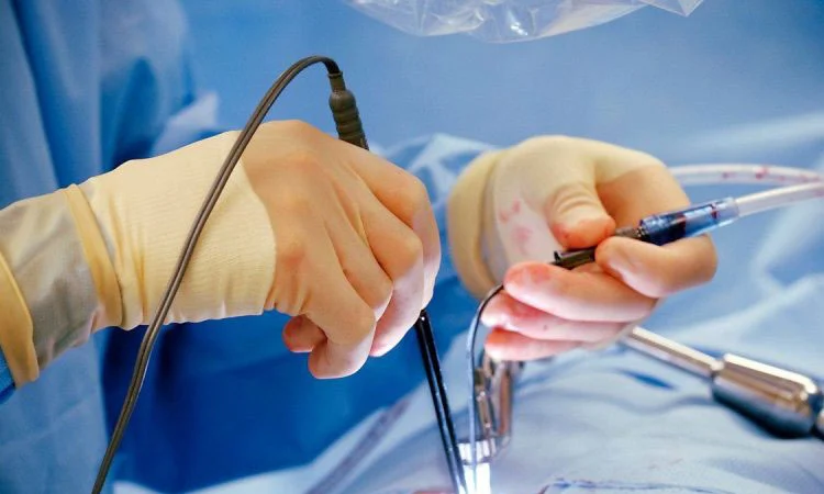 خدمات لیزر بیماریهای نشیمنگاه