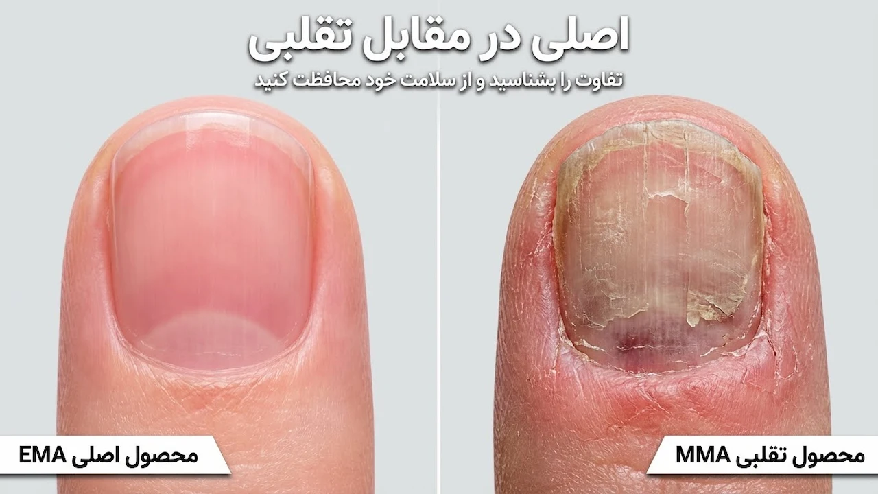 عوارض خاموش و هولناک مواد تقلبی کاشت ناخن؛ هشدار جدی به بانوان و ناخن‌کاران