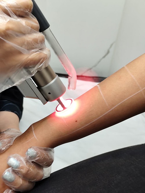 مرکز لیزر وی آی پی خانه اصفهان ، بهترین مرکز لیزر اصفهان