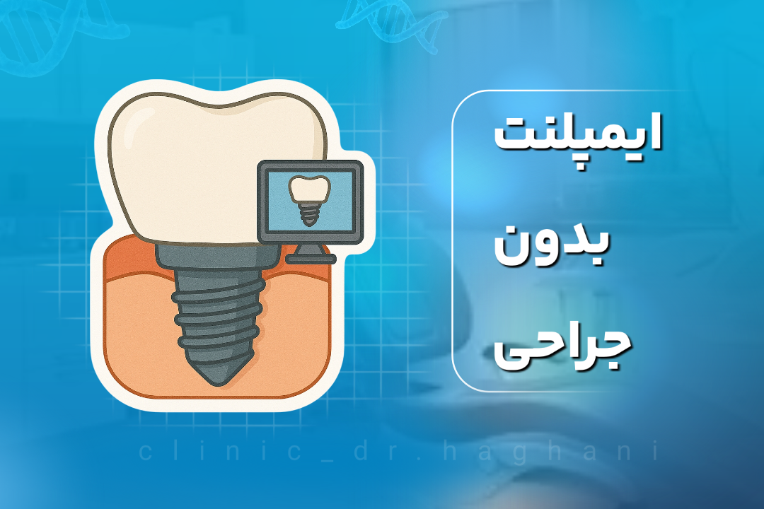 ایمپلنت بدون جراحی
