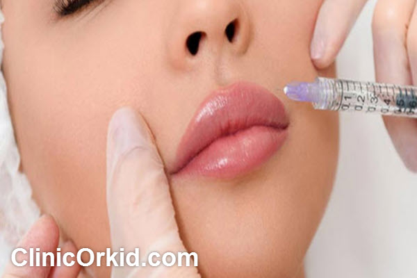 بهترین دکتر برای تزریق ژل در غرب تهران | کلینیک ارکید