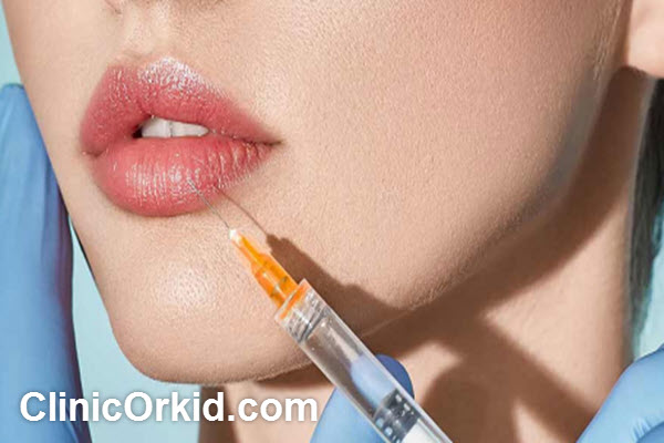 ویژگی های بهترین دکتر برای تزریق ژل در غرب تهران | کلینیک ارکید