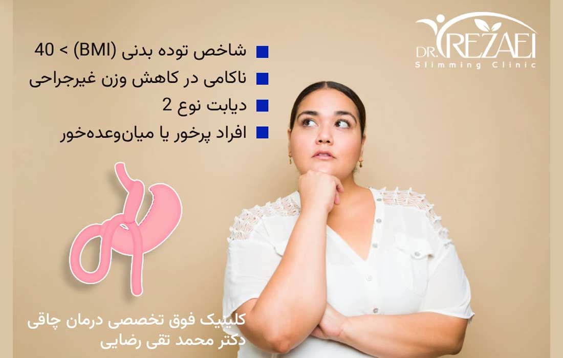 کاندید جراحی مینی بای پس معده