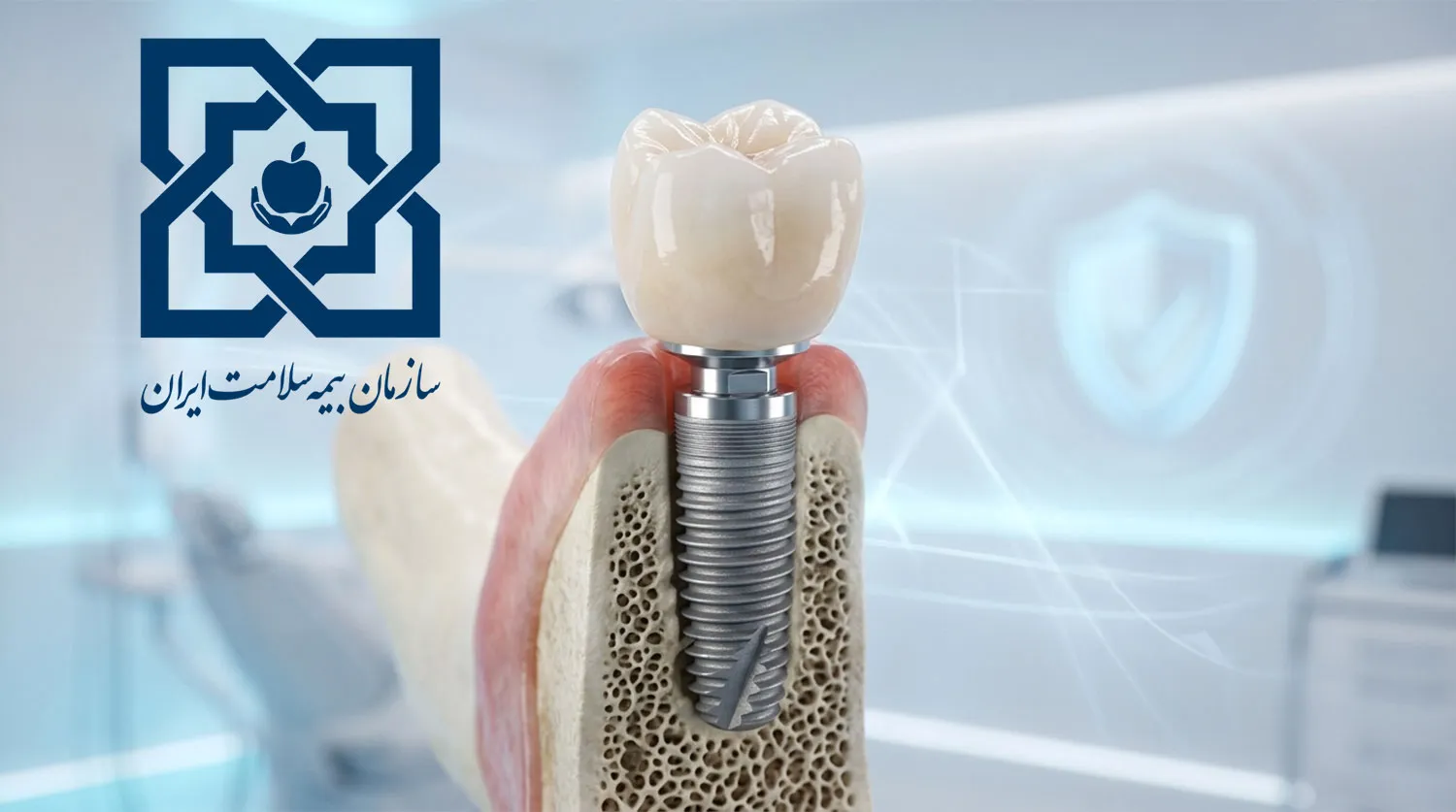 salamat-insurance-implant-cost