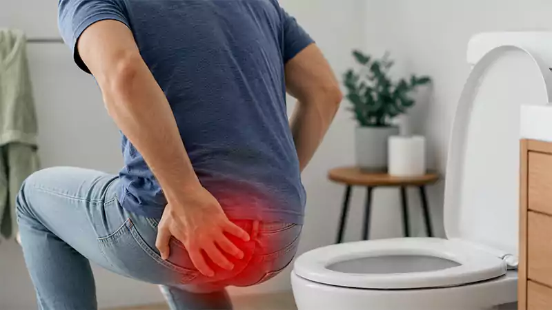 شایع‌ترین ناراحتی‌های مقعدی