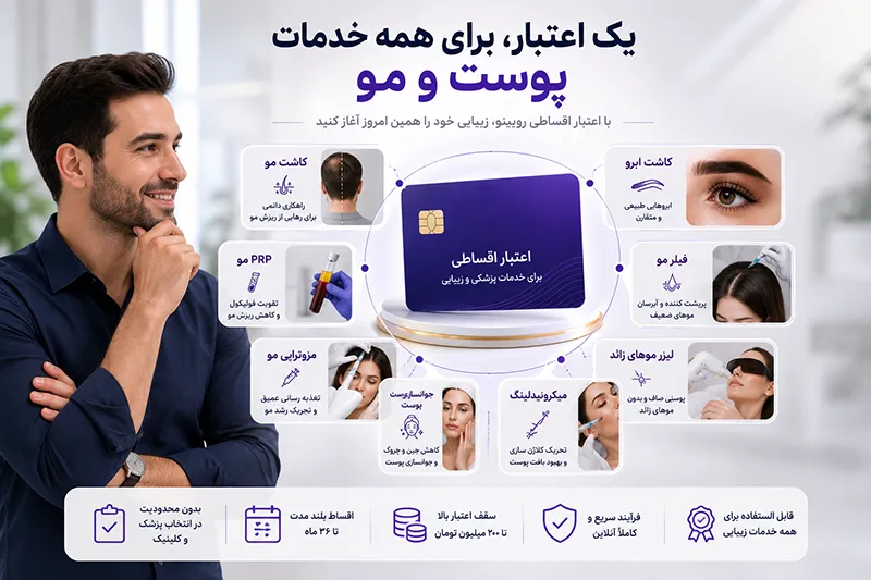 کاشت مو قسطی در رویینو
