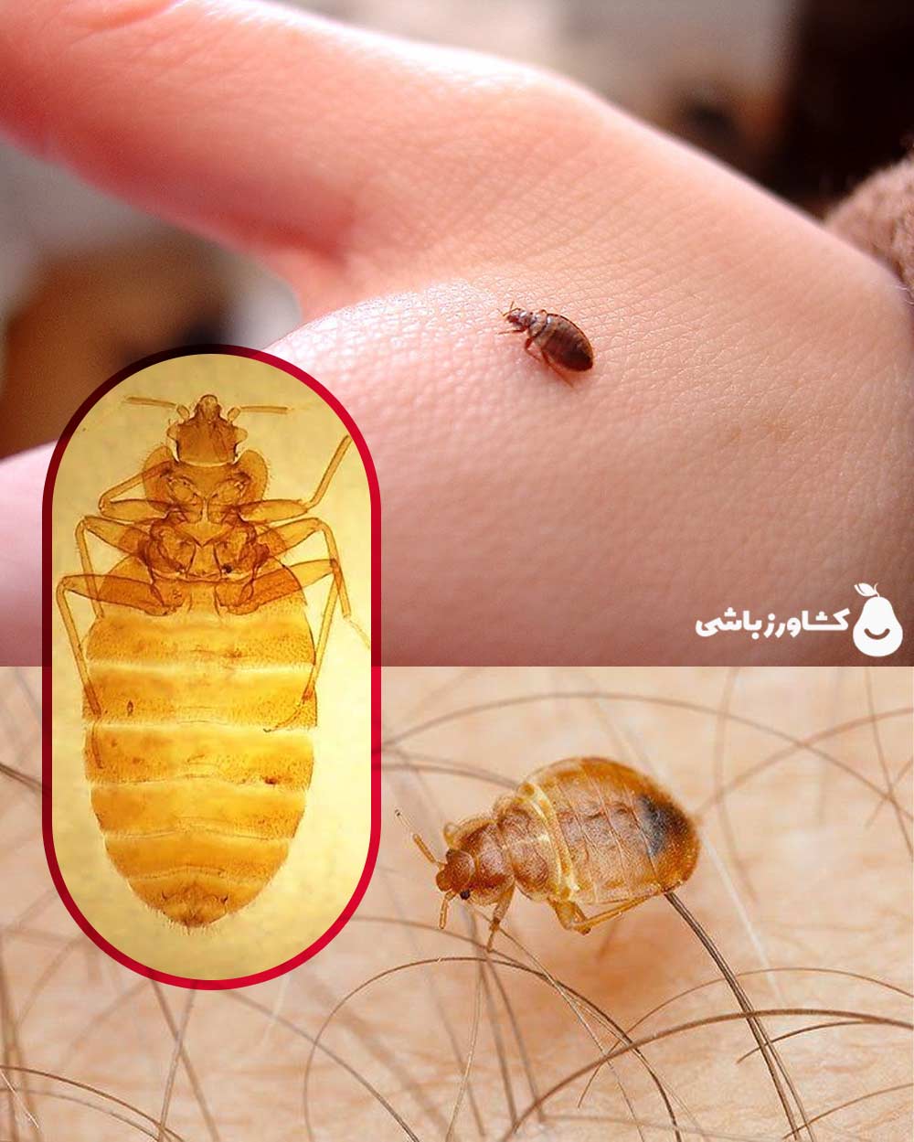 علت جان سخت بودن ساس - عکس حشره ساس