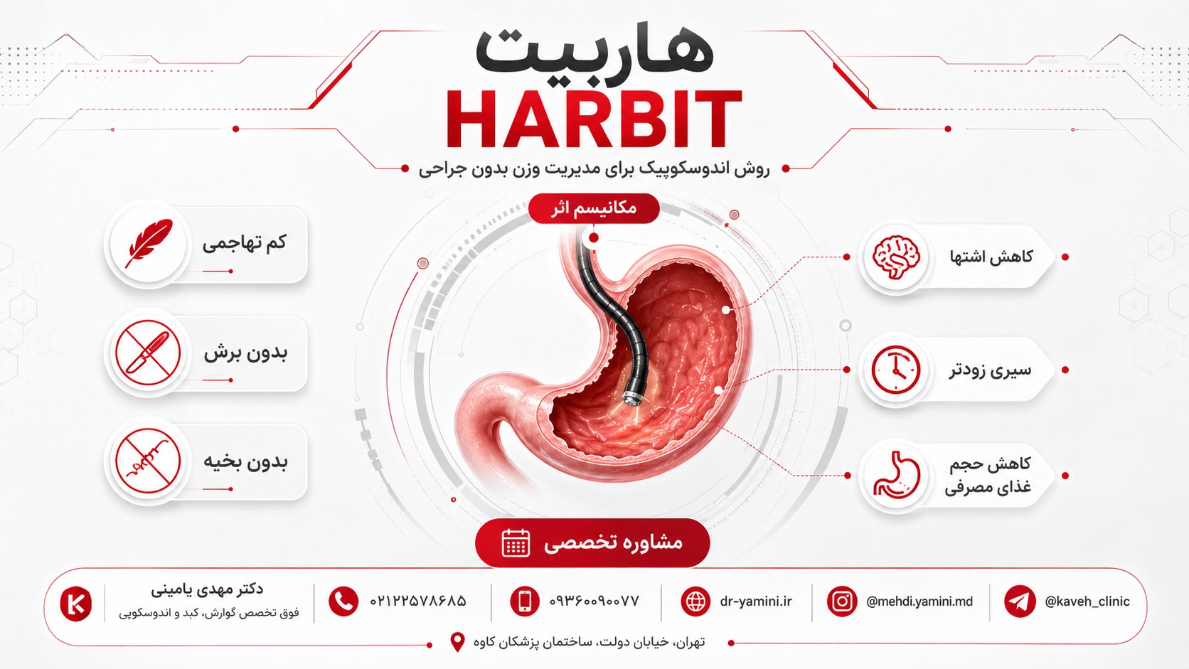 هاربیت لاغری چیست؟ معرفی روشی برای کاهش اشتها و کنترل وزن بدون جراحی