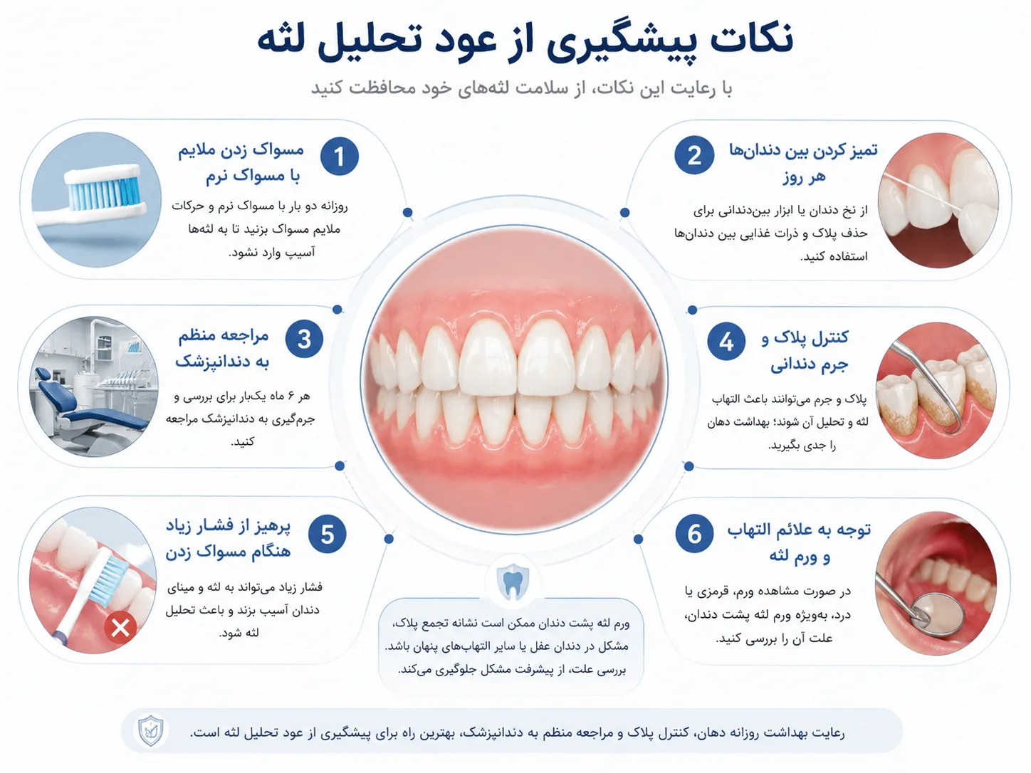 نکات پیشگیری برای جلوگیری از تحلیل لثه