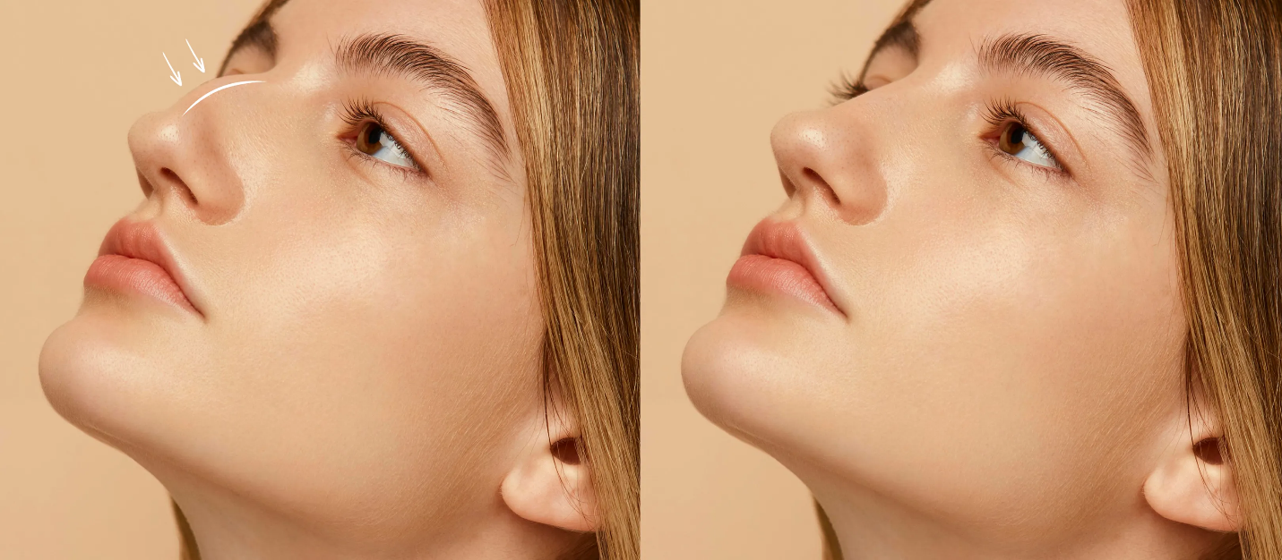 چگونه جراح بینی را انتخاب کنیم؟ 7 معیار مهم قبل از رینوپلاستی