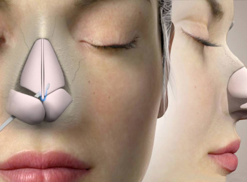 چگونه جراح بینی را انتخاب کنیم؟ 7 معیار مهم قبل از رینوپلاستی