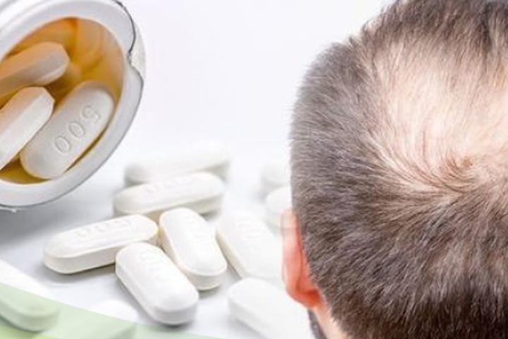 C:\Users\s\Desktop\Introducing-the-best-anti-hair-loss-pills-for-men-3.jpg
