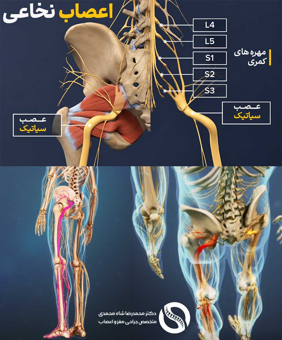 آناتومی عصب سیاتیک - عصب سیاتیک کجای بدن است
