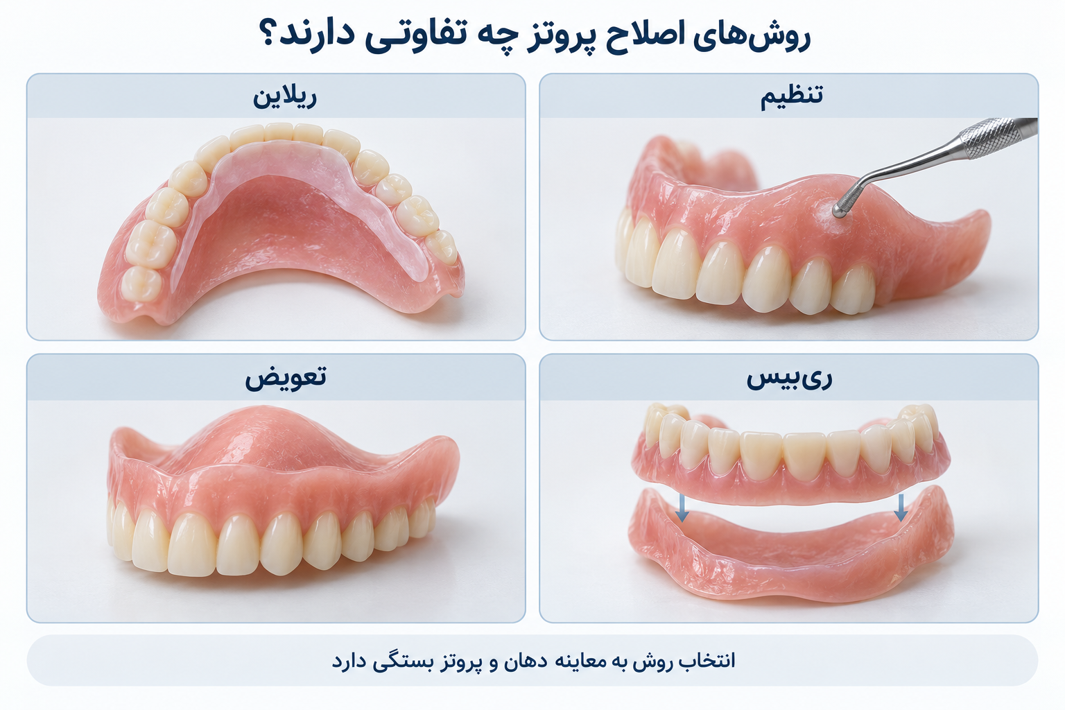اینفوگرافیک تفاوت تنظیم، ریلاین، ریبیس و تعویض دندان مصنوعی؛ انتخاب روش پس از معاینه